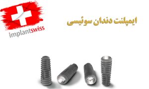 ایمپلنت سوئیسی