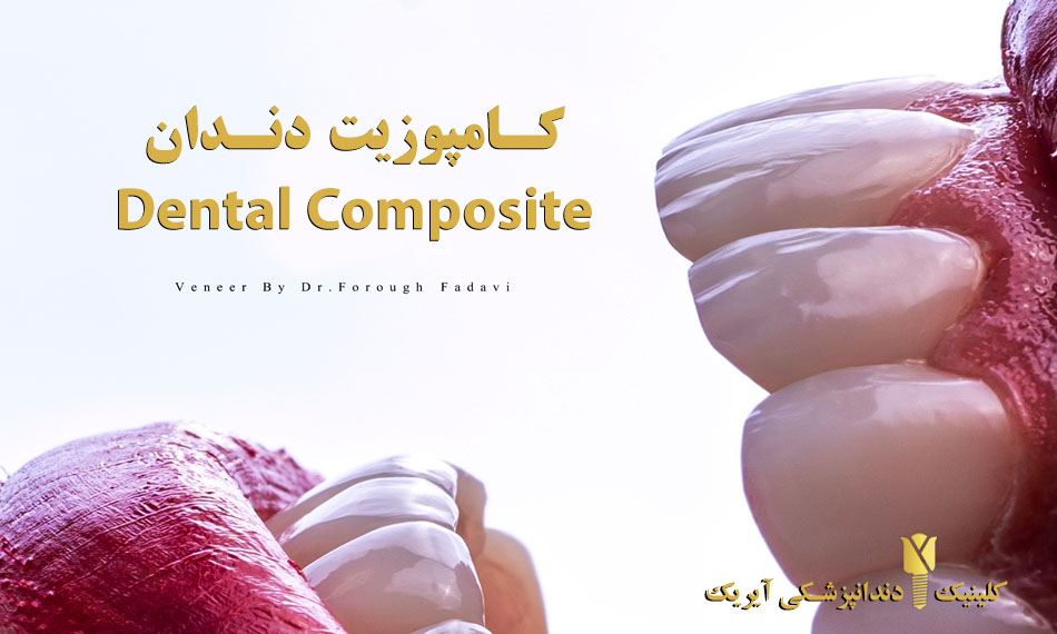 کامپوزیت دندان dental composite