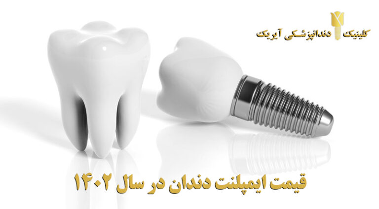 ایمپلنت دندان 1402